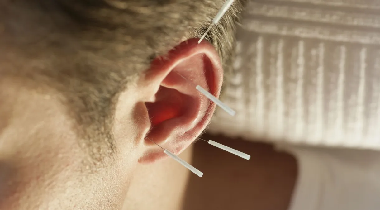 Acupuntura auricular mostrou ser benéfica para o tratamento da depressão em estudo nacional fStop Images/GettyImages