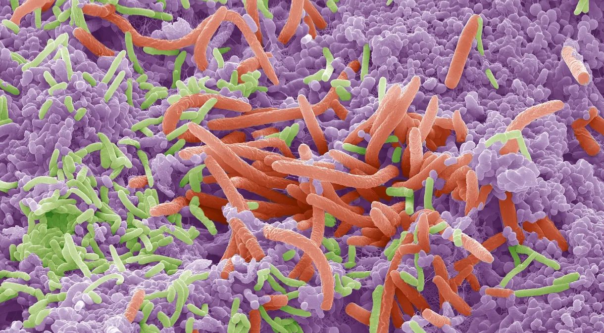 Bacteria - Steve Gschmeissner/Science Photo Library via Getty Images